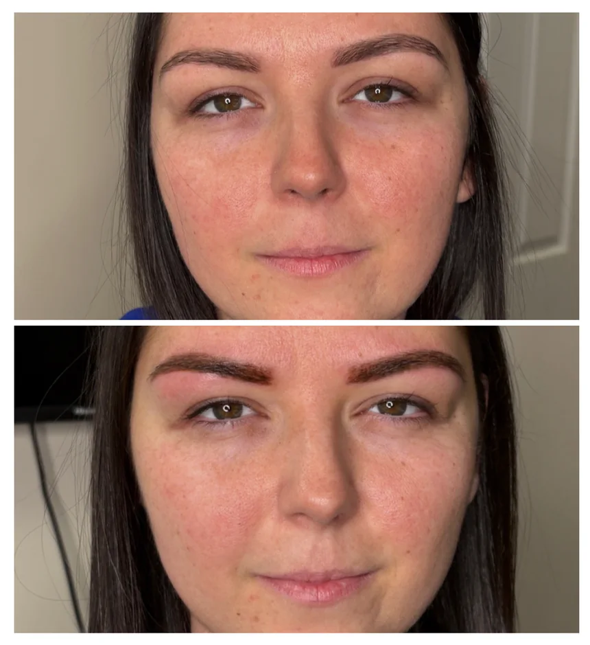 Before and after of a brow tattoo: sparse brows shaped into full, defined, natural brows